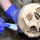 The skull of the Pompeii victim.